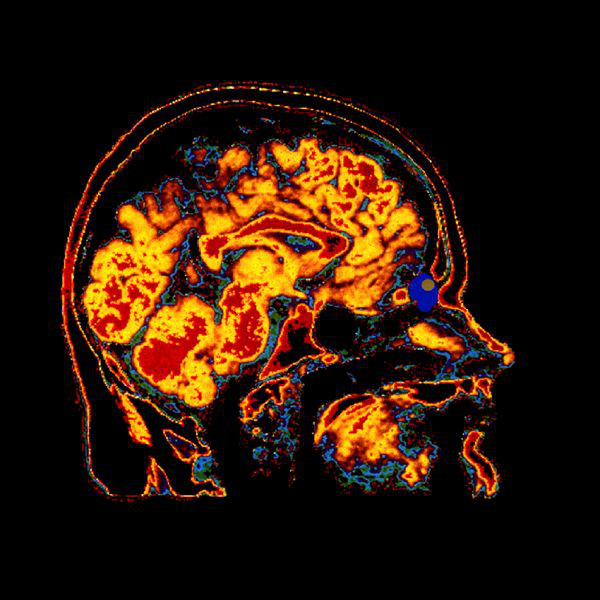 r-9072-1289433618-jpeg